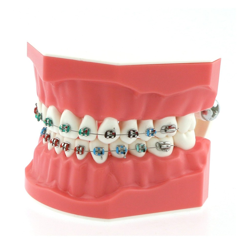 US Dental Typodont Brushing Flossing Practice Teeth Model with Metal Brackets
