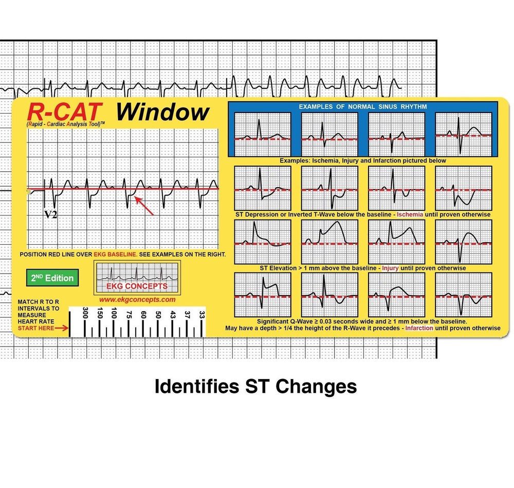 EKG Window 2nd Edition