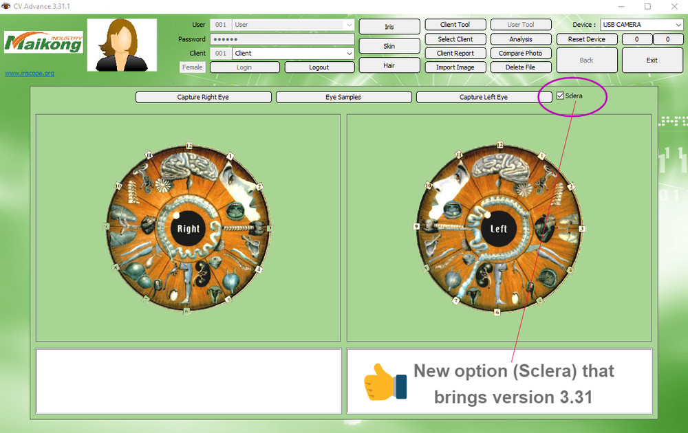 Analyzer Camera HD Iriscope Eye Camera with English Analysis Software for Eye US