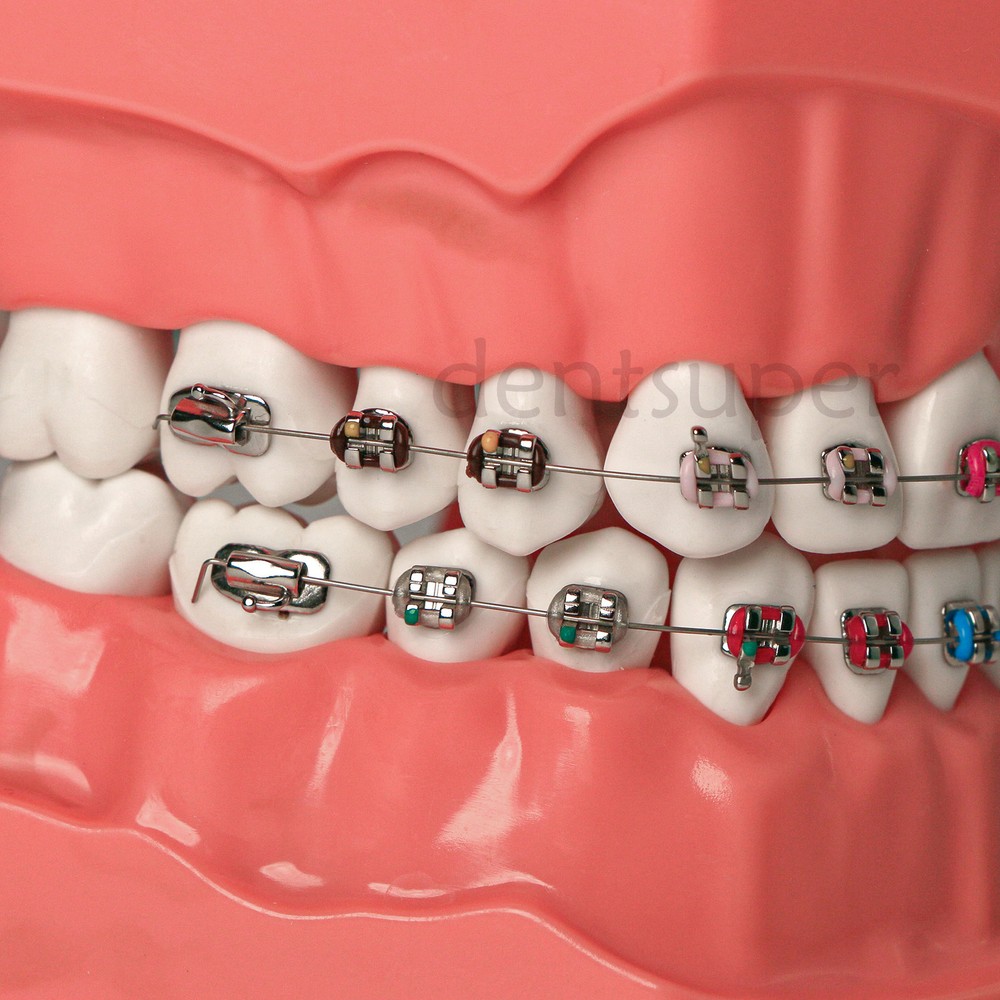 US 1:1 Dental Orthodontic Teeth Model Typodont Demonstration Model with Brackets