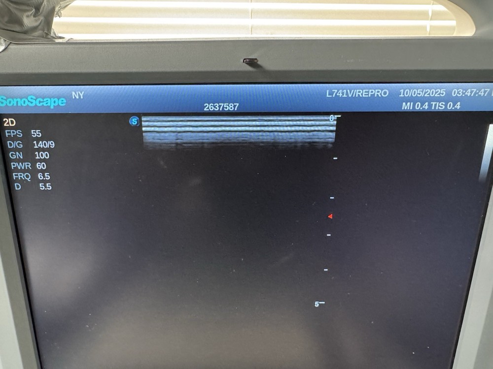 SonoScape Transducer L741V Linear Array/Rectal Probe