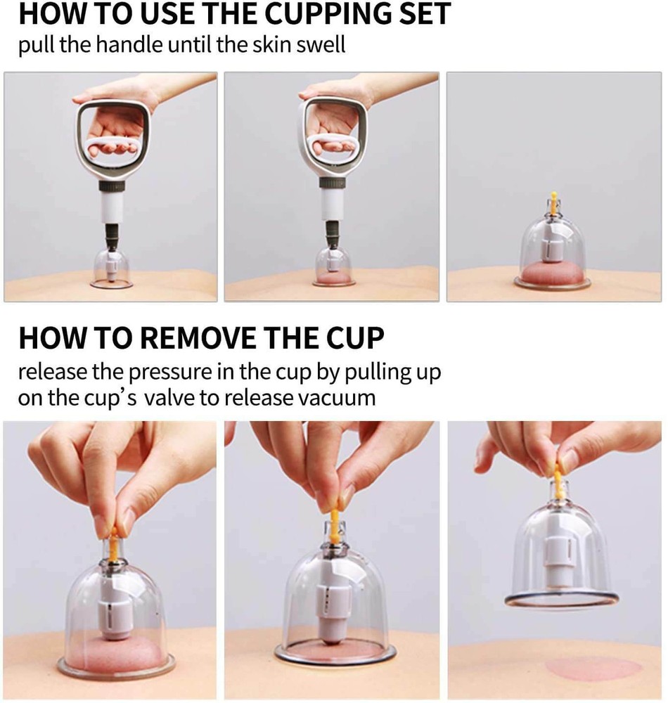 Professional Acupoint Cupping Set, 4th Generation Pump Gun & Cups (12 Cups)