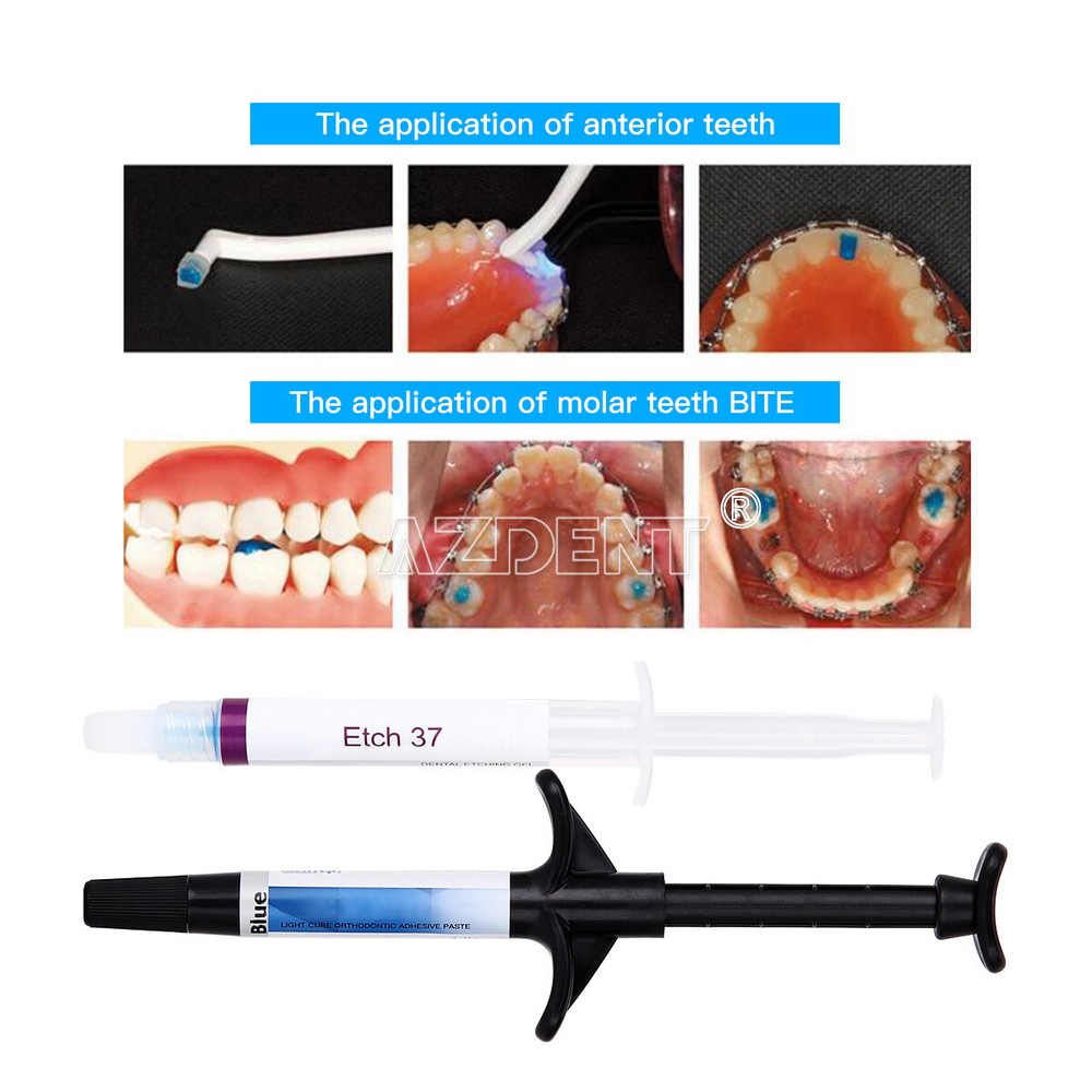 Dental Orthodontic Light Cure Adhesive Bonding Curing Paste Etchant Gel Kit