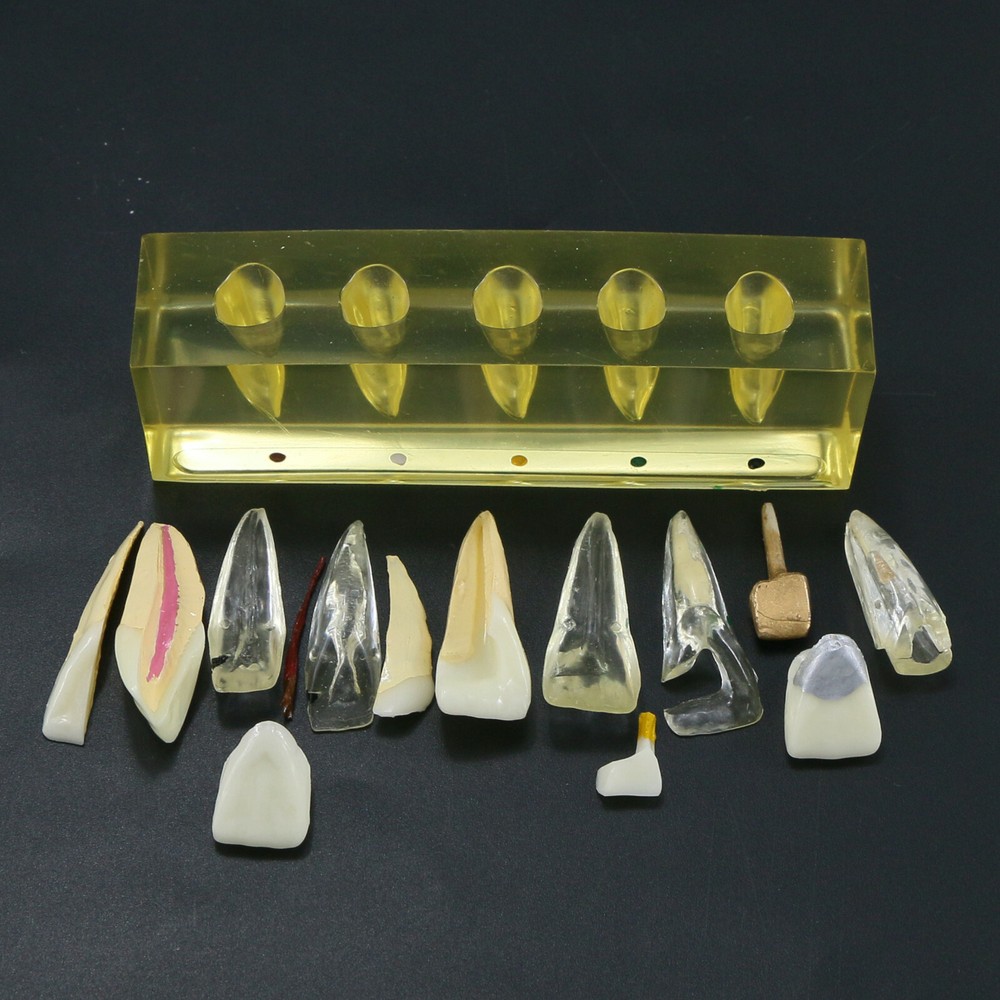Endodontic Treatment Root Canal Tooth Teach Study Dental Teeth Removable Model