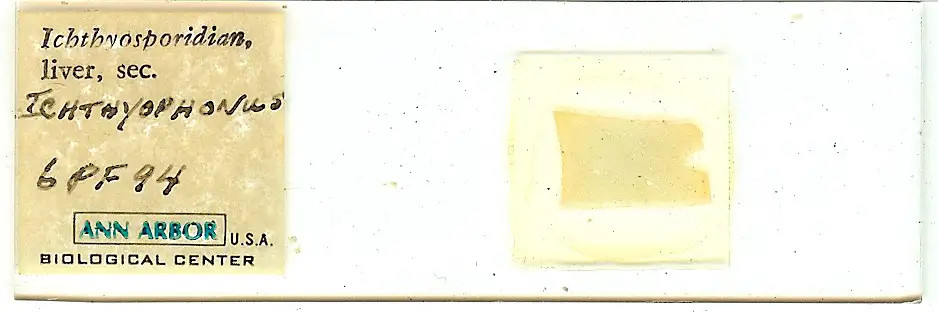 Ichthyosporidian in liver Microscope Slide