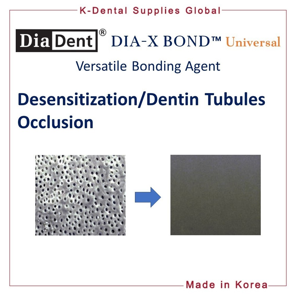 Diadent Dia-X Bond Universal Versatile Dental Bonding Agent 5ml