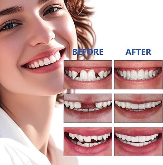 Teeth, Tooth Replacement Missing Teeth, Teeth Permanent Filling Kit & Tool, 50ML