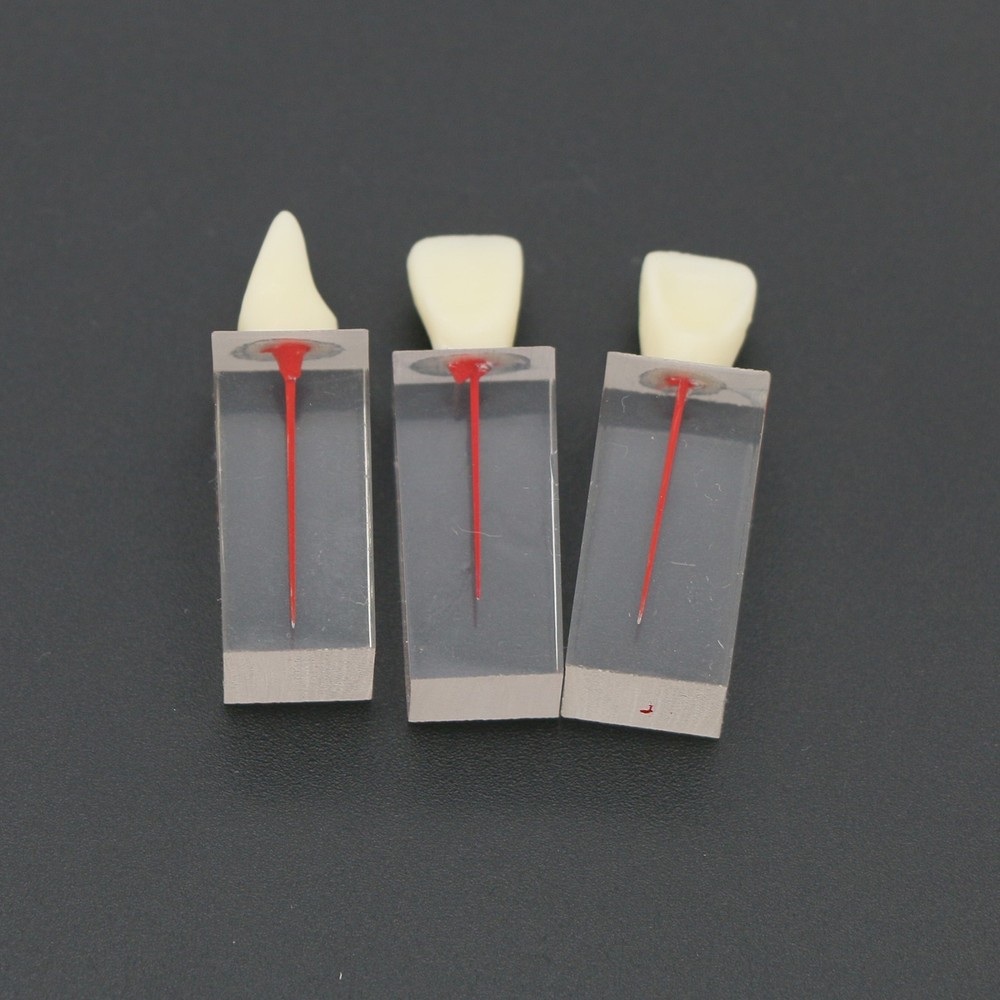 5Pcs Dental Root Canal Teeth molar Model Study Practice For Endodontic Pulp File