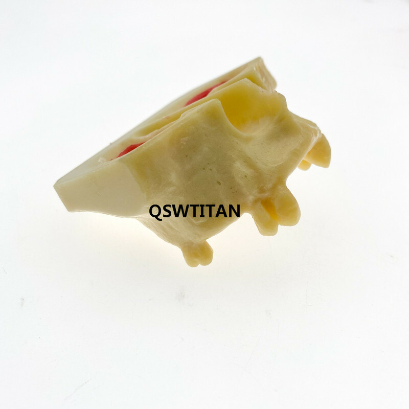 Dental Sinus Lift Practice Teeth Model Typodont Study Model 2013F