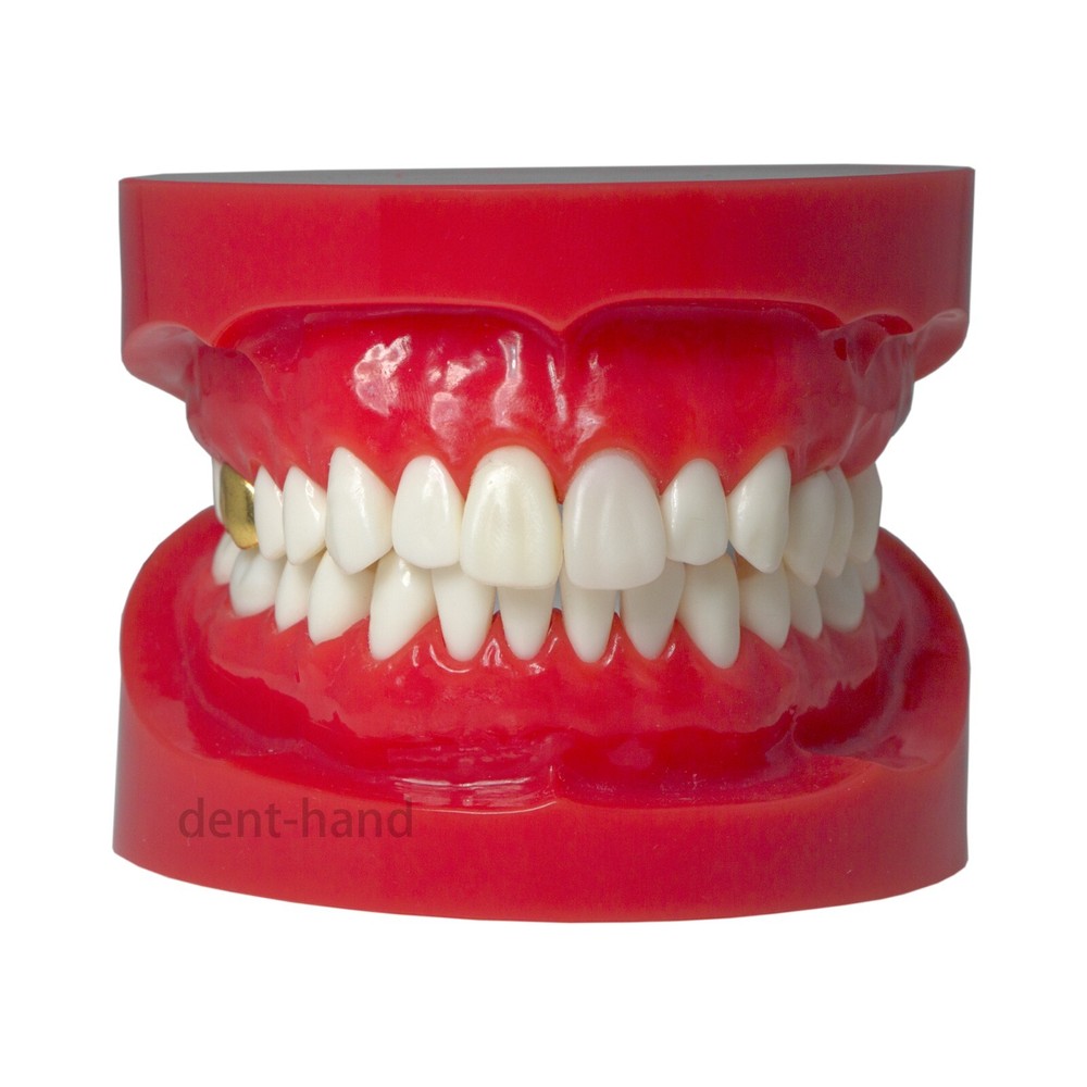 Dental Typodont Teeth Model Restoration Crown with Post Core Bridge M6004