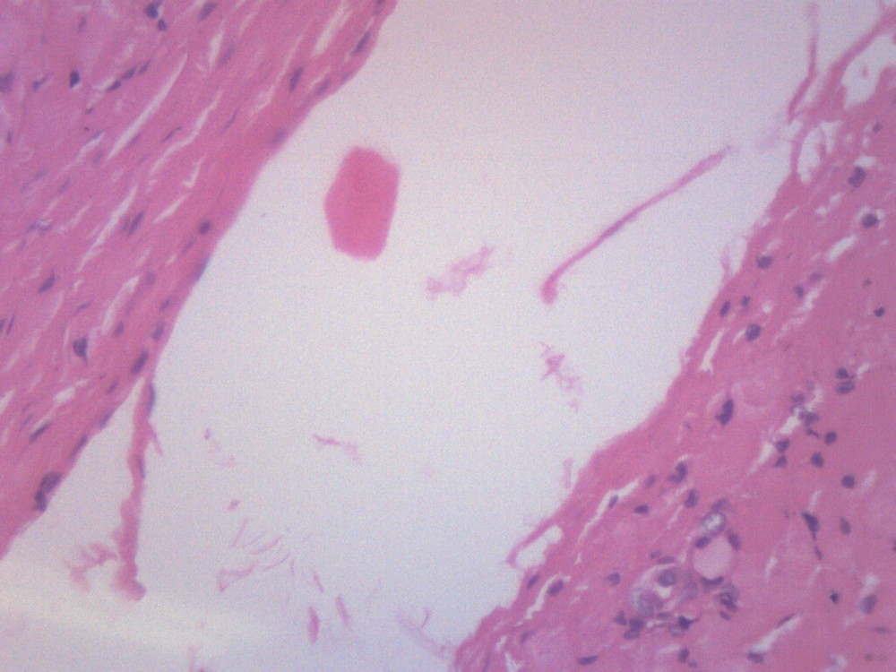 Human Artery & Vein, Prepared Microscope Slide - 75x25mm - Eisco Labs