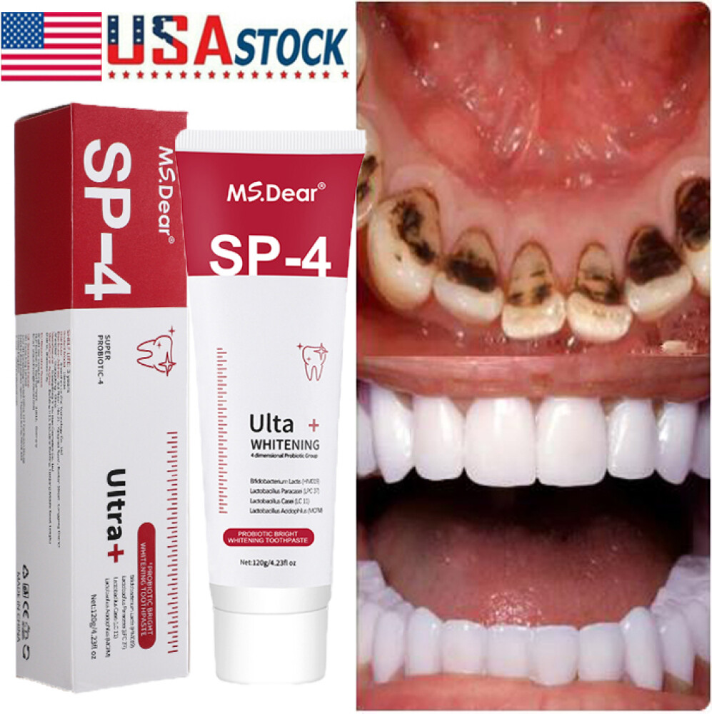 5PACK Toothpaste, Whitening Sp-4 Toothpaste, Sp-4 Probiotic Whitening Toothpaste