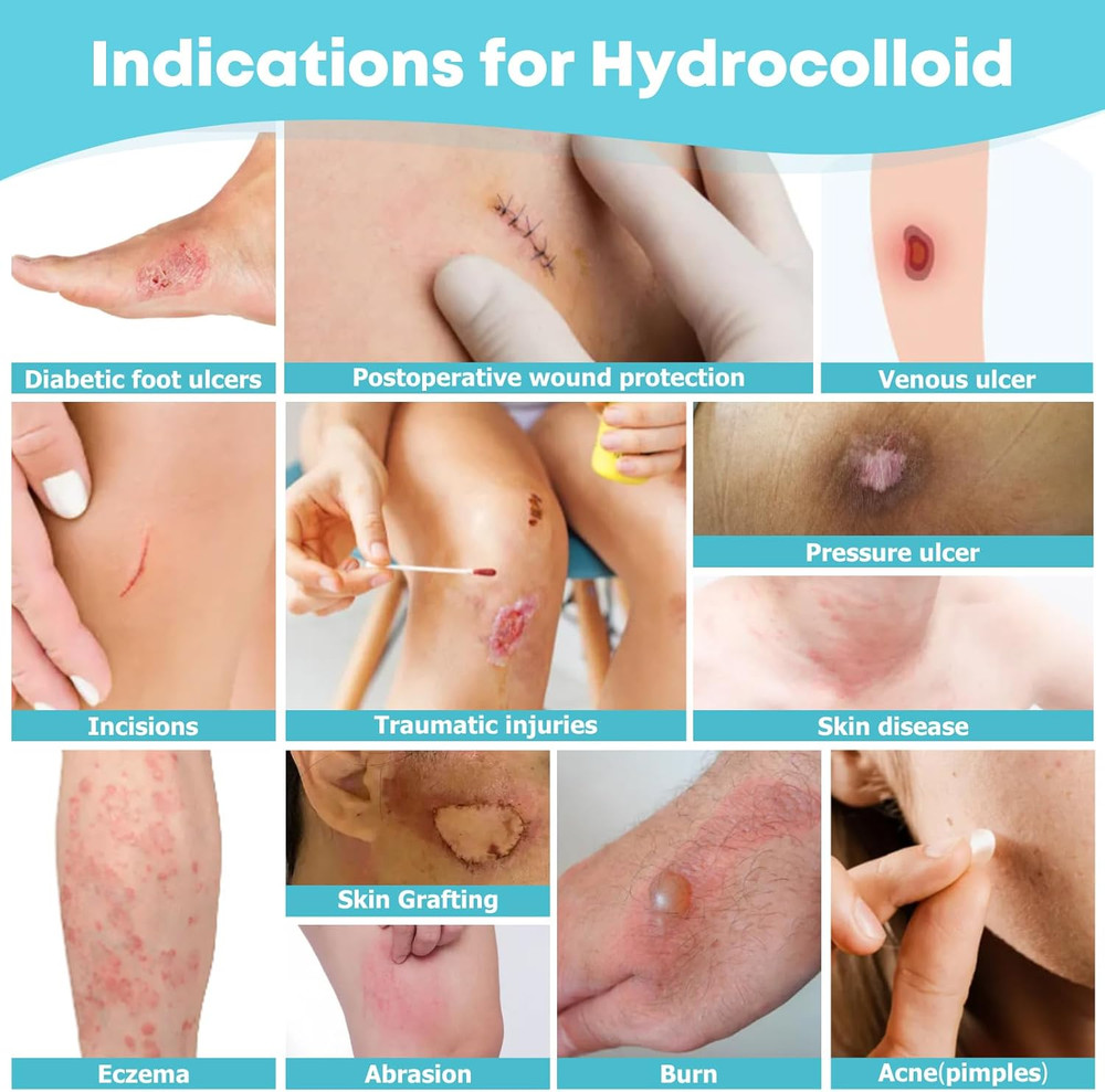 Hydrocolloid Roll for Wound Care - Cut-To-Size, Extra Large Hydrocolloid Patch B