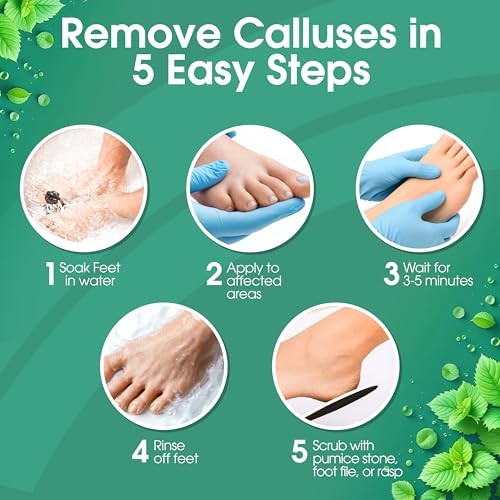 Callus Maintenance Pack, Bundle Includes Mint Scented 8 Ounce Kit Cool Mint