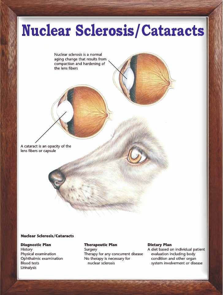 Nuclear Sclerosis/Cataracts Chart 12x18 inches