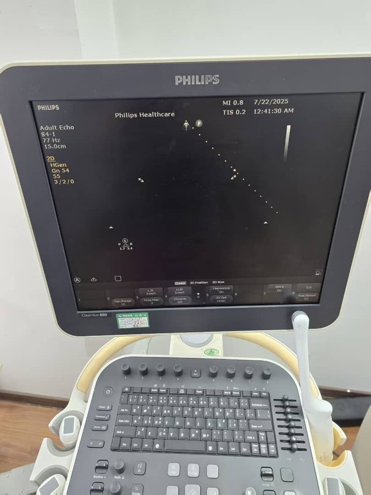 Philips S4-1 Transducer / Probe FOR CLEARVIEW