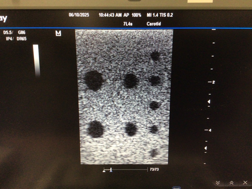 2012 Mindray 7L4s Linear Array Ultrasound Probe