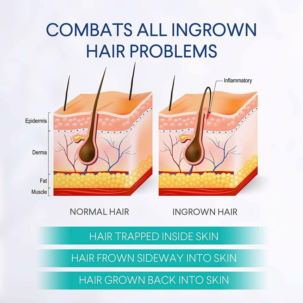 Razor Bumps Solution, After Shave for Ingrowns and Burns, Dark Spot Corrector
