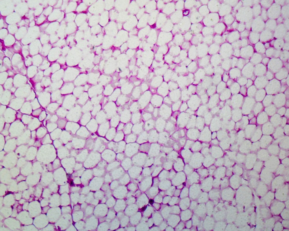 Slide, Adipose Tissue, Human; Section