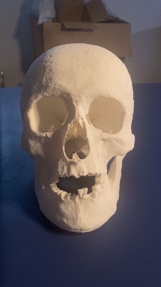 Human Skull Replica Large 3d Print Anatomically Correct