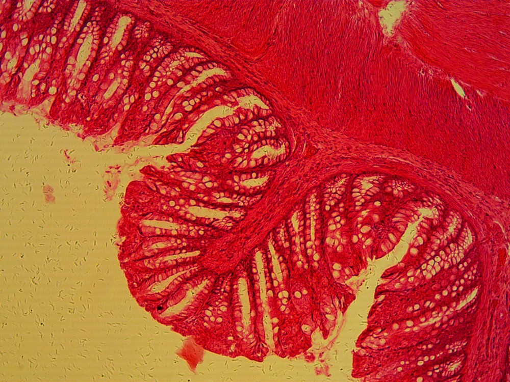 *Sale* Reconditioned AO Compound Microscope, 100X, 430X!