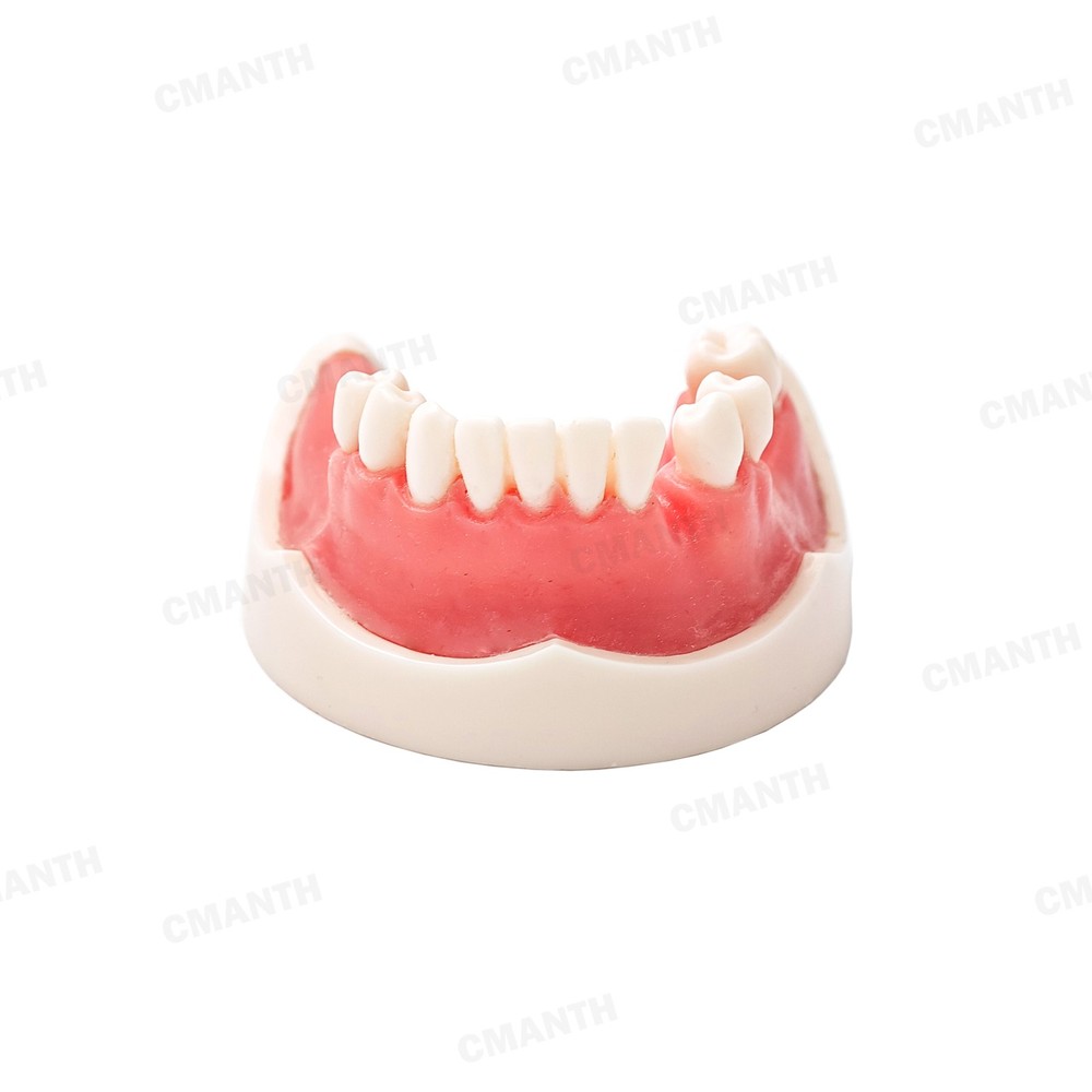 US Dental Teeth Implant Model Soft Gums Model Drilling Open Suture Practice