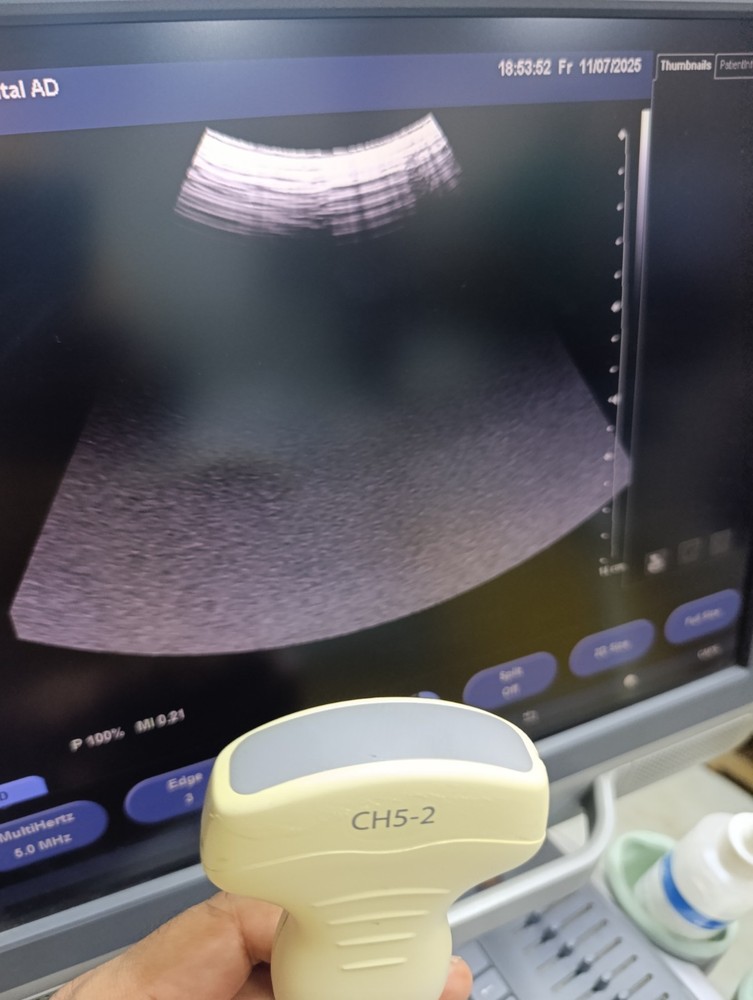 Siemens Convex Probe CH5-2