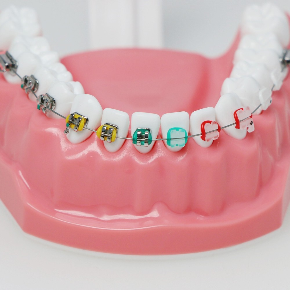 Dental 1:1 Teach Study Typodont Teeth Model Half Metal Ceramic Brackets Tubes