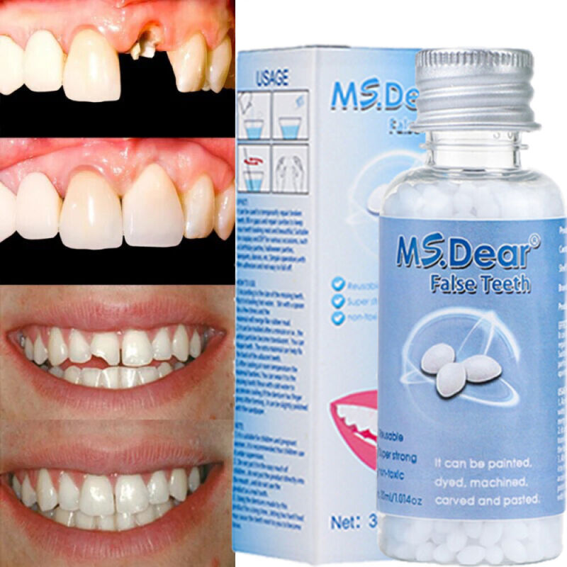Temporary Tooth Repair Kit Teeth Gaps False Teeth Solid Glue Denture Adhesive