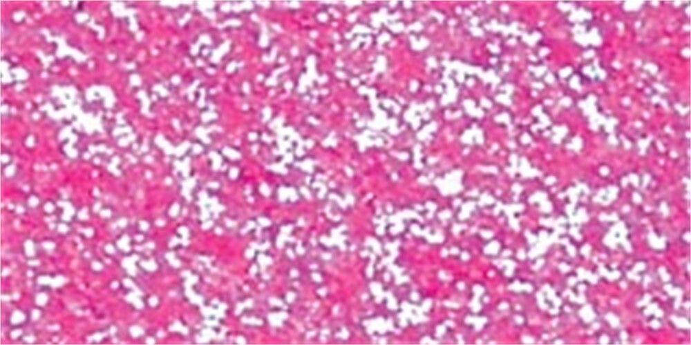 Stickles Glitter Glue .5oz-Glam Pink - 6 Pack