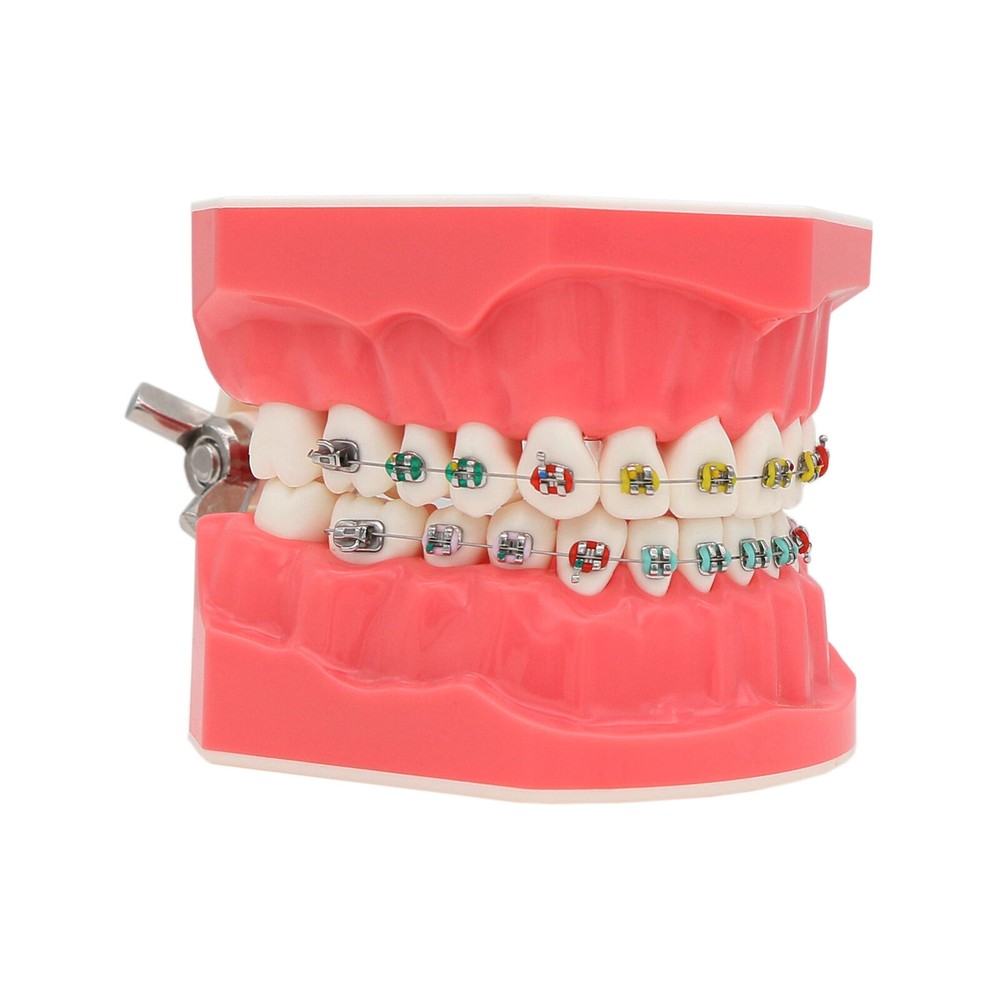1:1 Dental Teach Study Typodont Teeth Model With Metal Ceramic Brackets Tubes