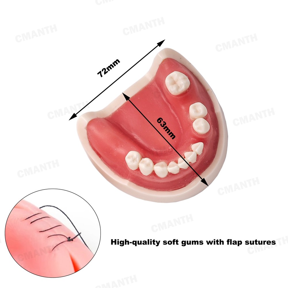 US Dental Teeth Implant Model Soft Gums Model Drilling Open Suture Practice