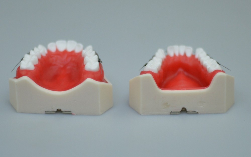 New Reusable Dental Practical Training Model/typodont/orthodontics Wax Model