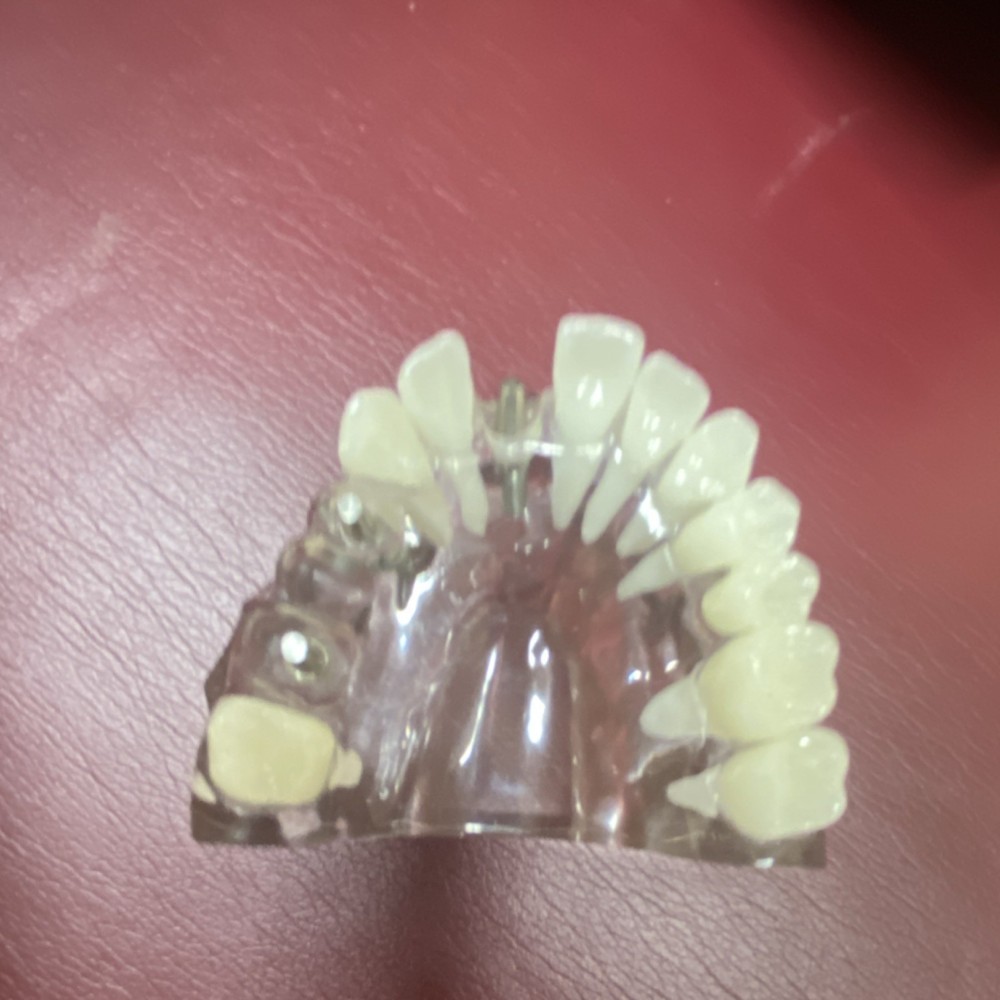 Practicon Transparent Implant Crown & Bridge Typodont Model 4071920 Dentistry