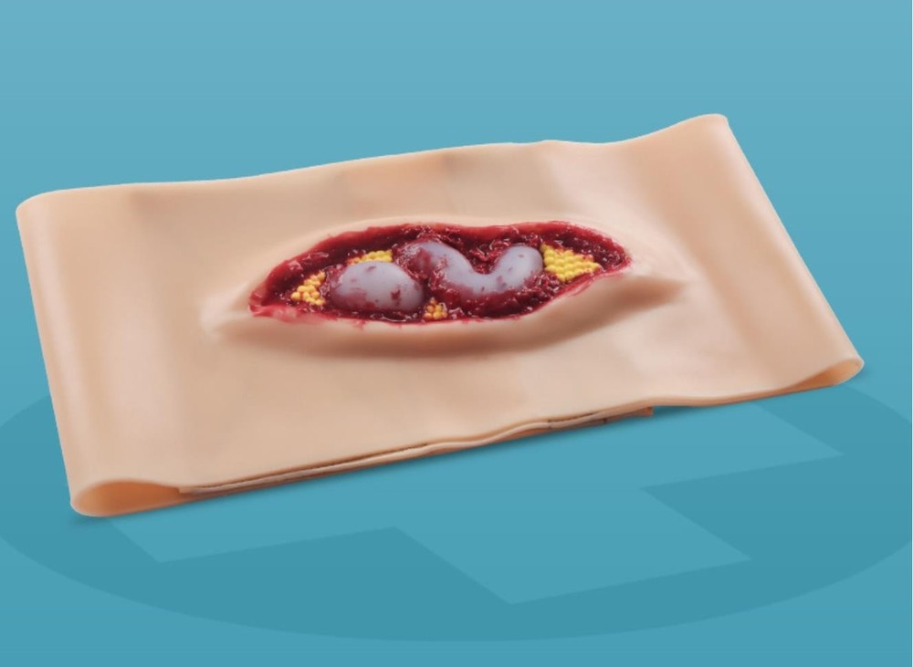 Abdominal Anatomical Wound Training Model