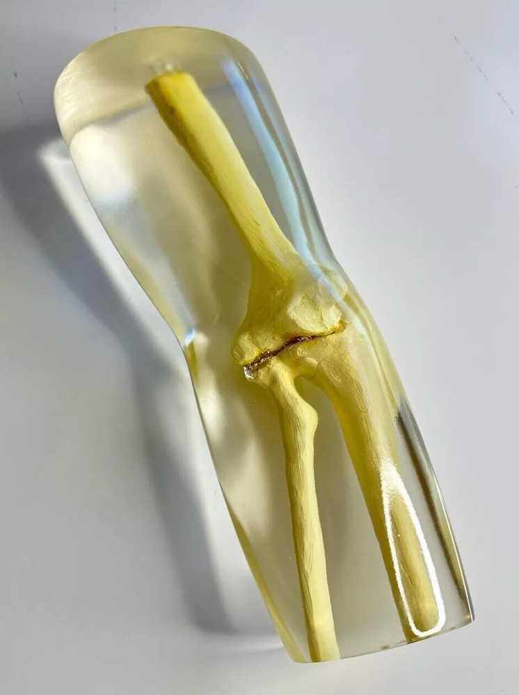 RSD Phantoms Natural Transparent Mannequin Elbow (Testing & Calibration)