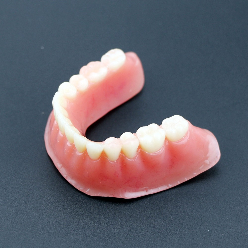 Dental Teeth Model Inferior Overdenture Precision 4 Implants Demo Silver Bar
