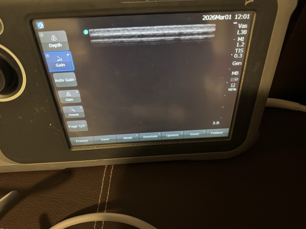 SonoSite L38n/10-5 MHz Linear Array Transducer Probe