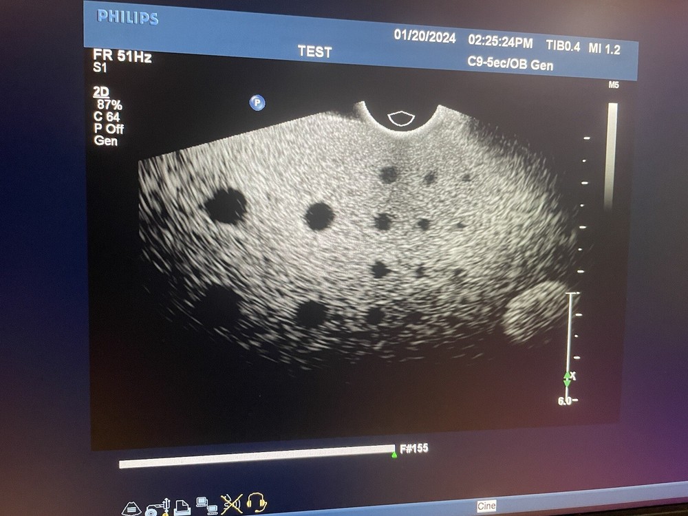Philips C9-5ec Ultrasound Transducer Endocavity Curved Array Broadband Probe