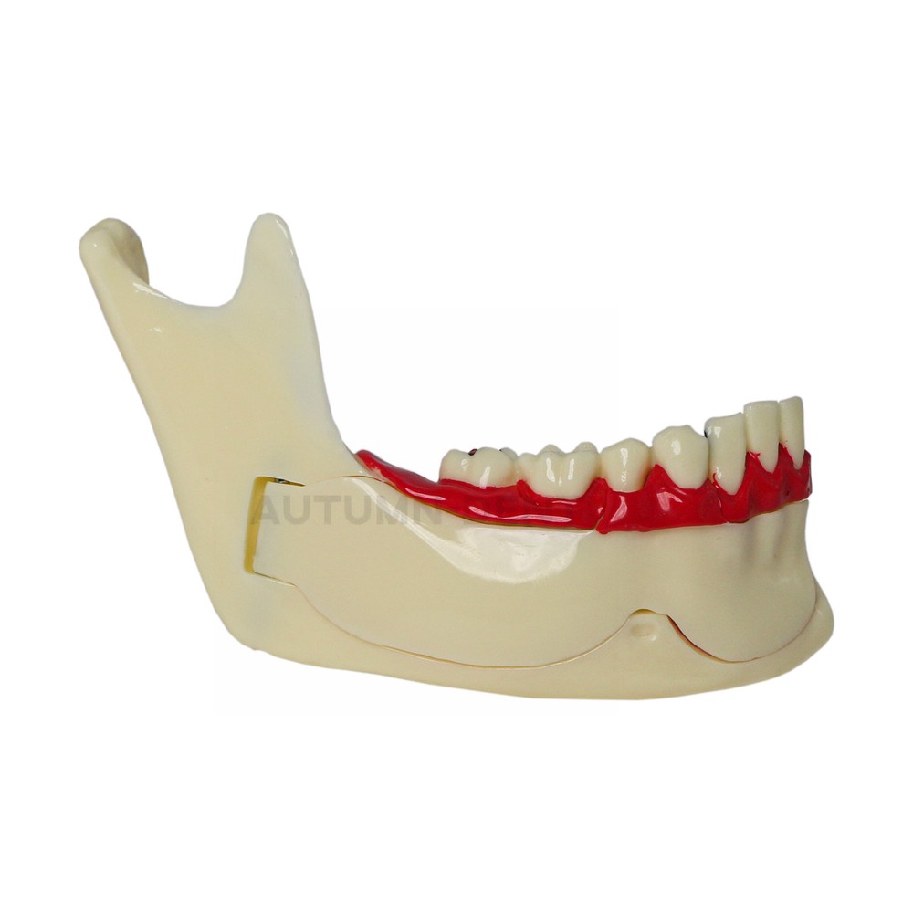 Dental Mandibular Tissue Teeth Anatomical Model Patient Teach Study Education