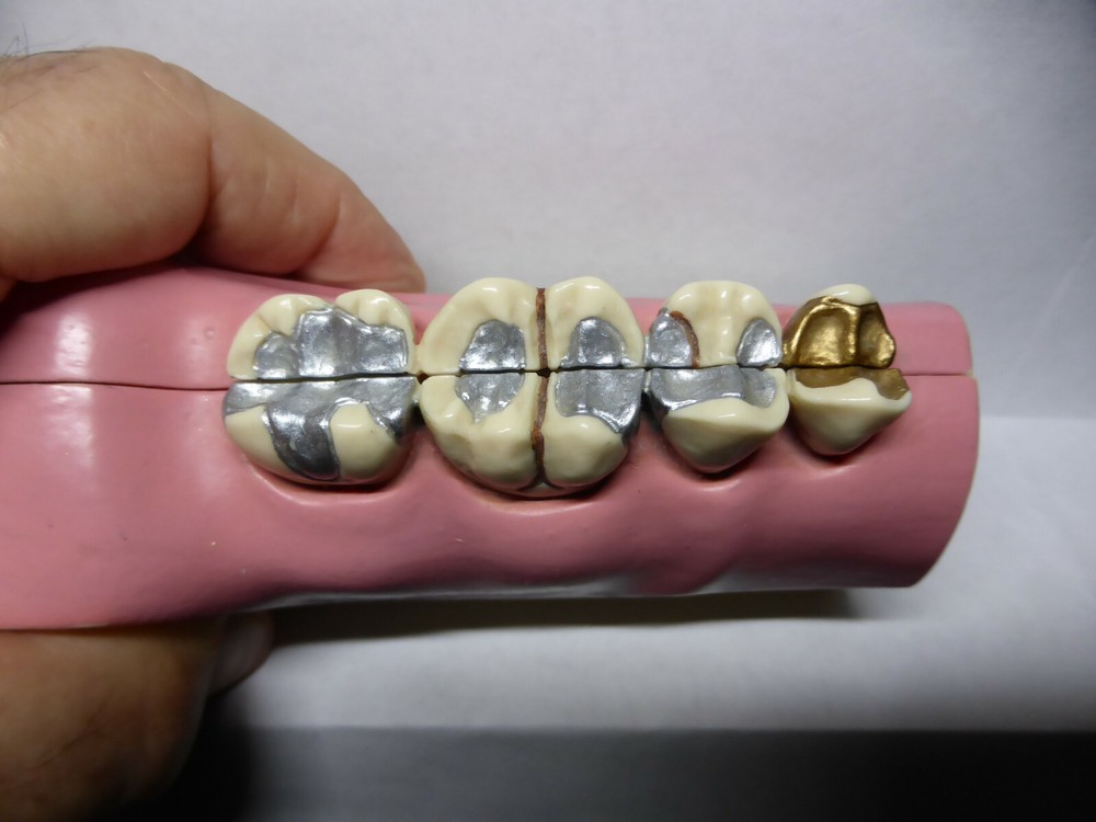 Typodont, Common Dental Pathologies Model, Patient instruction, x- section