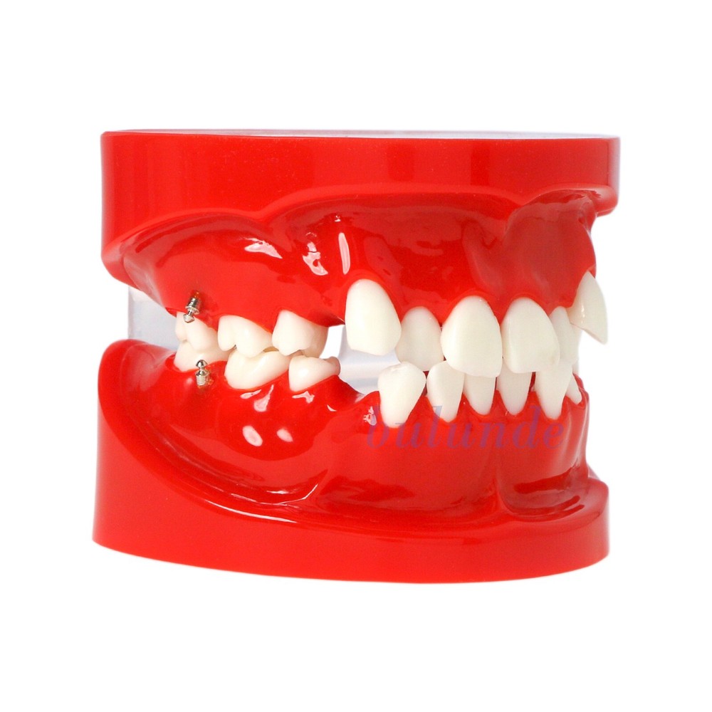 Dental Multi Typodont Teeth Model for Implant Pathological Restoration Practice
