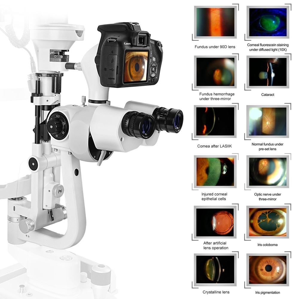 LED Digital Slit Lamp Imaging System Optical Galilean Five Steps Magnification