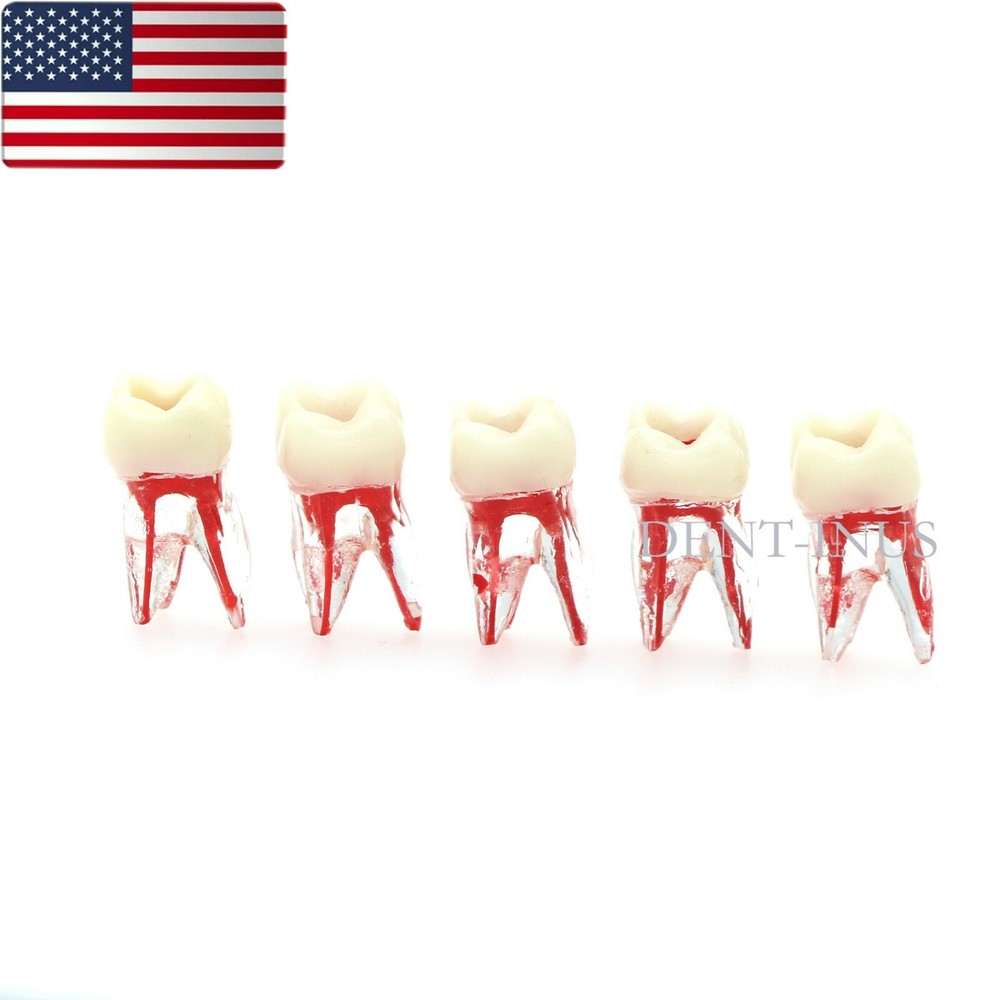 US Dental Endo Molar Root Canal Study Practice Block Pulp Cavity Model RCT/MTA