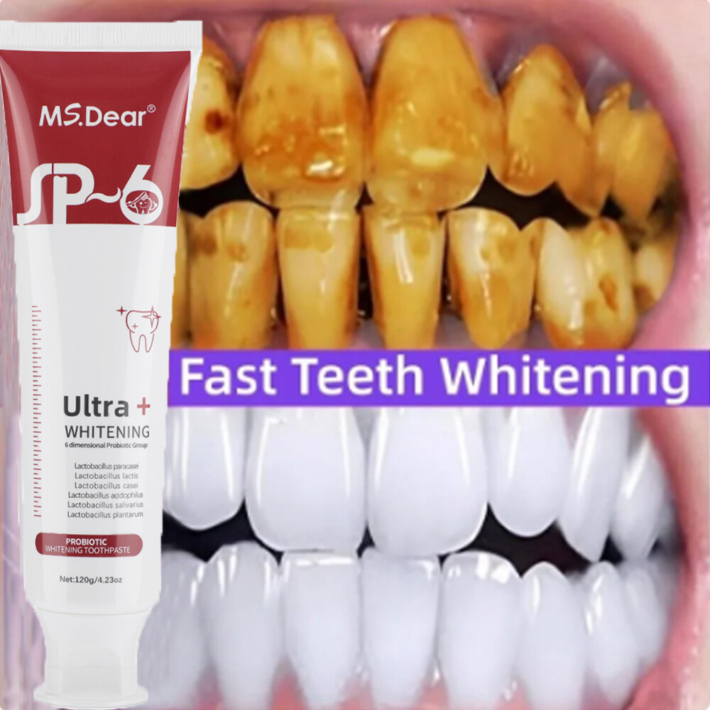 2Pcs Super Probiotic SP-6 Toothpaste, Probiotics Bright White Toothpaste, Sp 6
