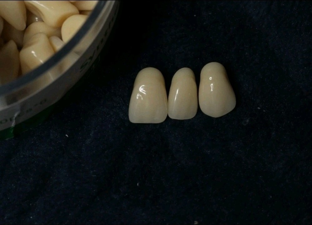 Multi-layer Composite Resin Teeth Dental Laboratory. Includes 20 full sets