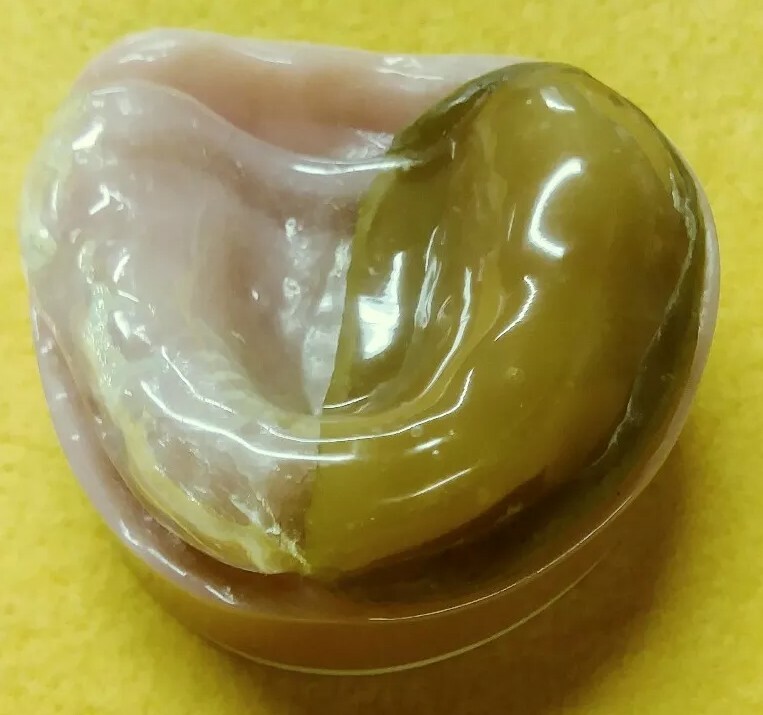 Cleft Palate DENTAL LAB DEMONSTRATION TEACHING MODEL Lab. Dentist ODD RARE
