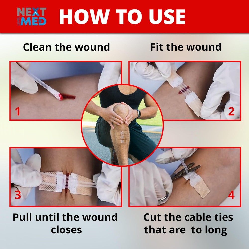 NEXT LEVEL MED Steri-Stitch Wounds & Cuts Closure Kit - Comprehensive First-A...
