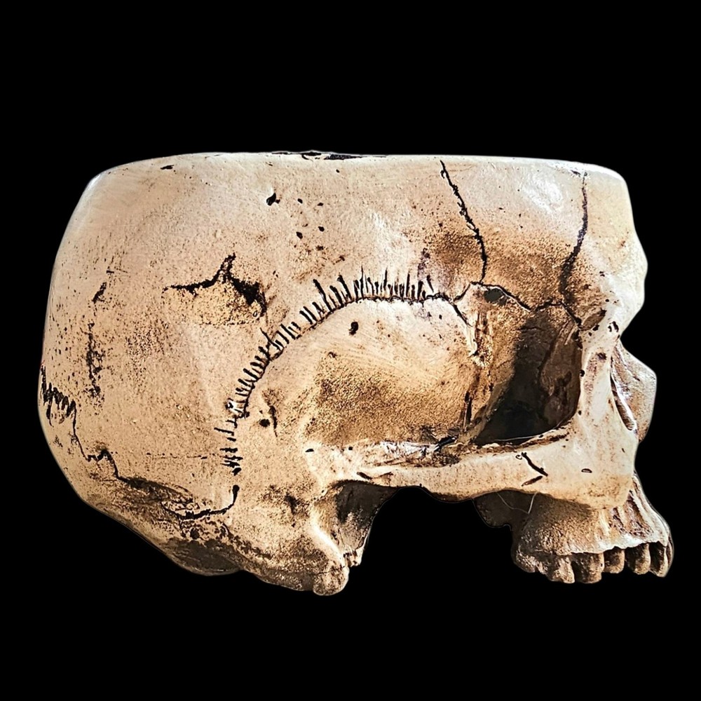 Trunk Of Requirements Experimental Test Subject Skull