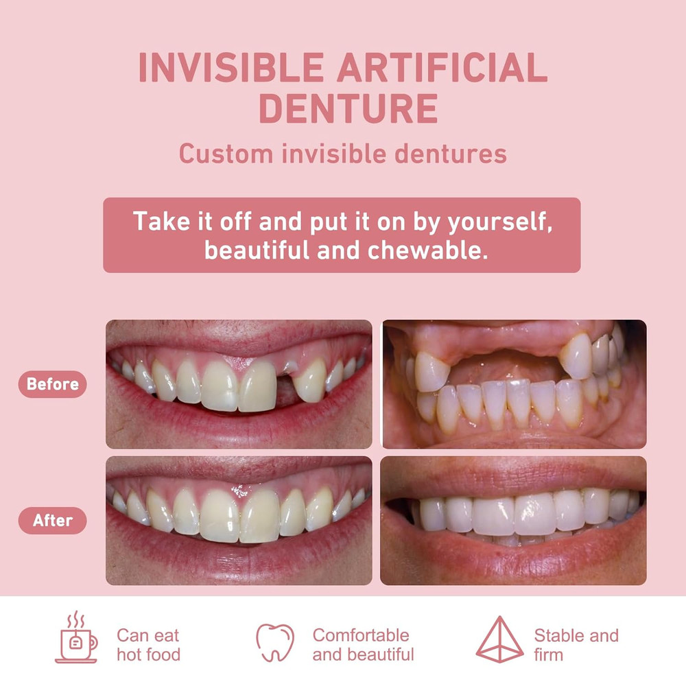 Custom Partial Dentures – Personalized Removable Denture Set for Missing Teeth |